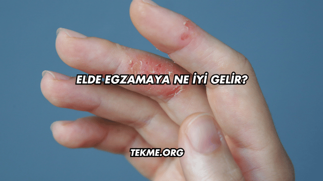 Elde Egzamaya Ne İyi Gelir?