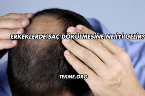 Erkeklerde Saç Dökülmesine Ne İyi Gelir?