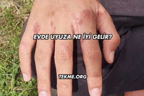 Evde Uyuza Ne İyi Gelir?