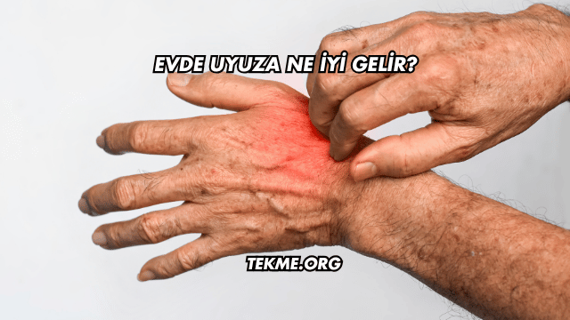 Evde Uyuza Ne İyi Gelir?