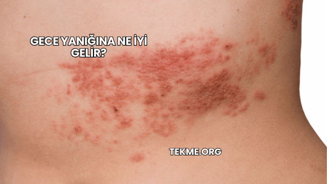 Gece Yanığına Ne İyi Gelir?