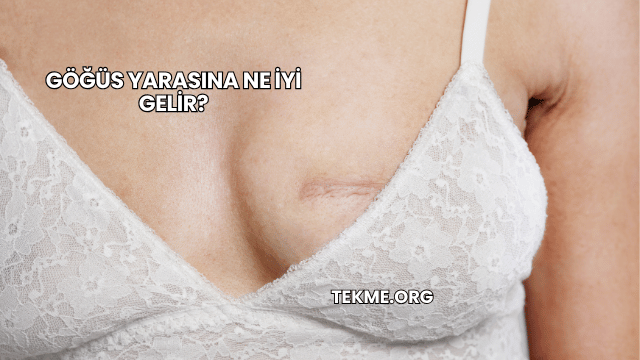 Göğüs Yarasına Ne İyi Gelir?