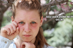 Göz Alerjisine Ne İyi Gelir?