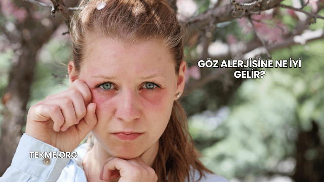 Göz Alerjisine Ne İyi Gelir?