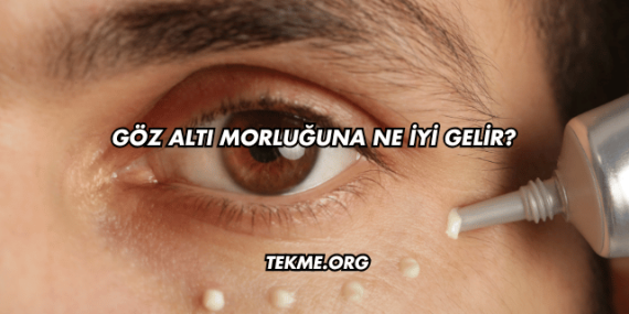 Göz Altı Morluğuna Ne İyi Gelir?