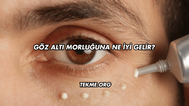 Göz Altı Morluğuna Ne İyi Gelir?