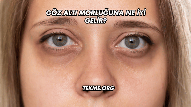 Göz Altı Morluğuna Ne İyi Gelir?