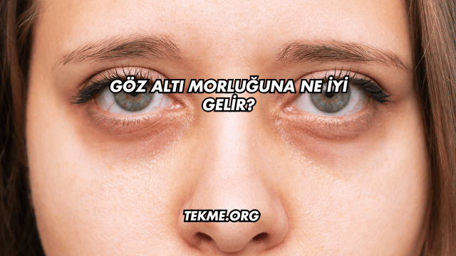 Göz Altı Morluğuna Ne İyi Gelir?