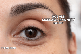 Göz Altı Morluklarına Ne İyi Gelir?
