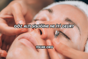 Göz Altı Şişliğine Ne İyi Gelir?