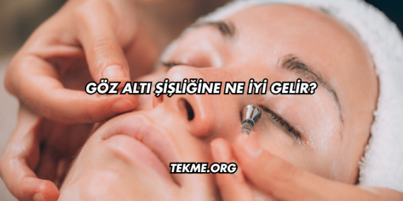 Göz Altı Şişliğine Ne İyi Gelir?