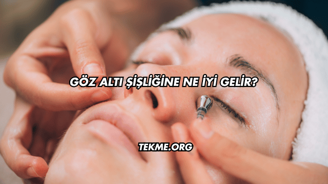 Göz Altı Şişliğine Ne İyi Gelir?