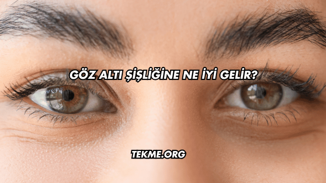 Göz Altı Şişliğine Ne İyi Gelir?
