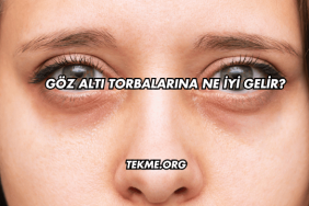 Göz Altı Torbalarına Ne İyi Gelir?