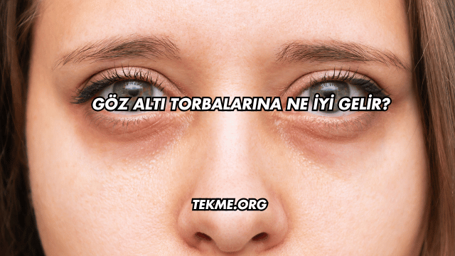Göz Altı Torbalarına Ne İyi Gelir?