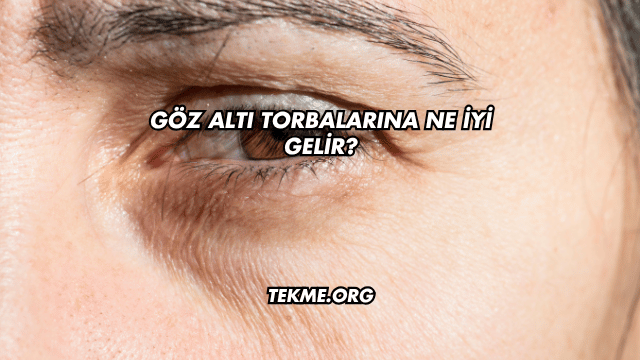 Göz Altı Torbalarına Ne İyi Gelir?