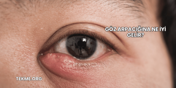 Göz Arpacığına Ne İyi Gelir?