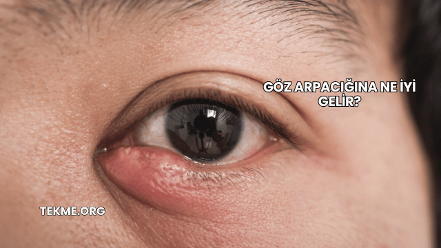 Göz Arpacığına Ne İyi Gelir?