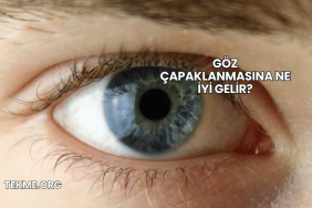 Göz Çapaklanmasına Ne İyi Gelir?
