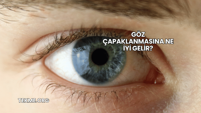Göz Çapaklanmasına Ne İyi Gelir?