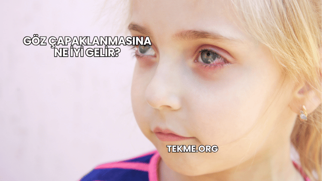 Göz Çapaklanmasına Ne İyi Gelir?