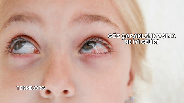 Göz Çapaklanmasına Ne İyi Gelir?