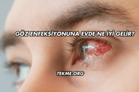 Göz Enfeksiyonuna Evde Ne İyi Gelir?