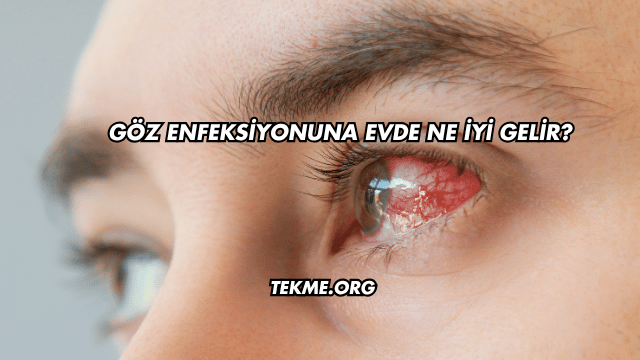 Göz Enfeksiyonuna Evde Ne İyi Gelir?