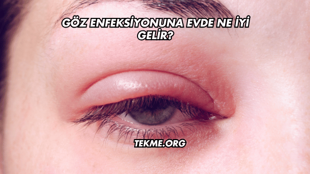 Göz Enfeksiyonuna Evde Ne İyi Gelir?