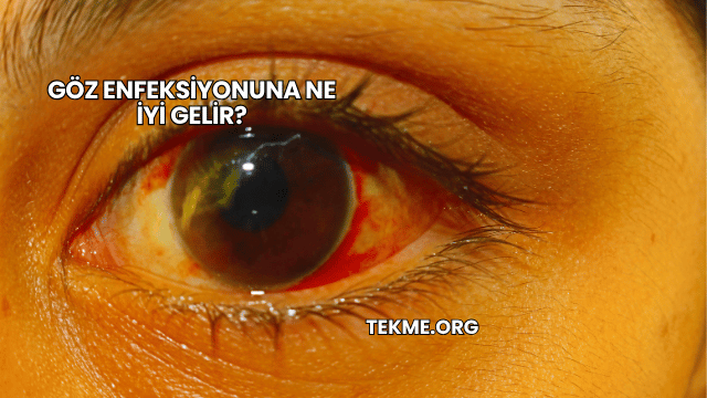 Göz Enfeksiyonuna Ne İyi Gelir?