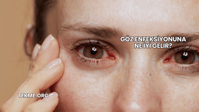 Göz Enfeksiyonuna Ne İyi Gelir?