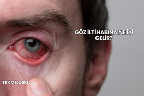Göz İltihabına Ne İyi Gelir?