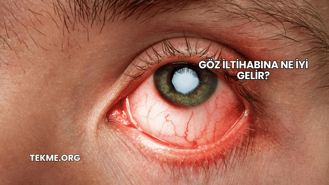 Göz İltihabına Ne İyi Gelir?