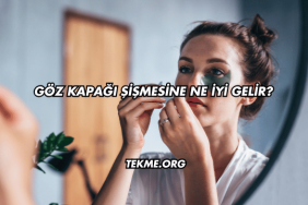 Göz Kapağı Şişmesine Ne İyi Gelir?