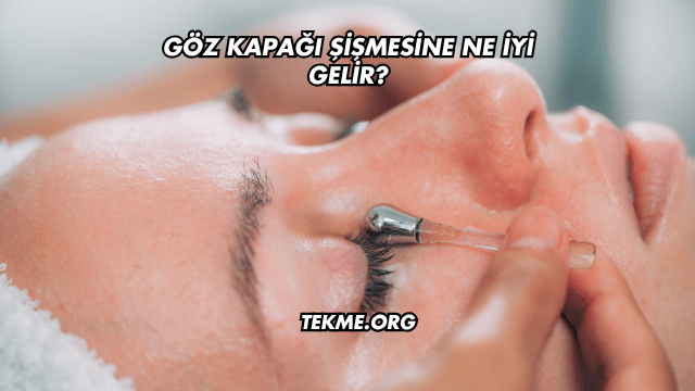 Göz Kapağı Şişmesine Ne İyi Gelir?