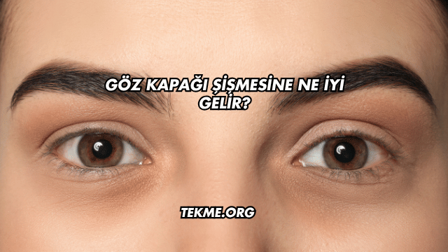 Göz Kapağı Şişmesine Ne İyi Gelir?