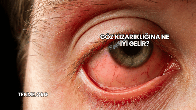 Göz Kızarıklığına Ne İyi Gelir?