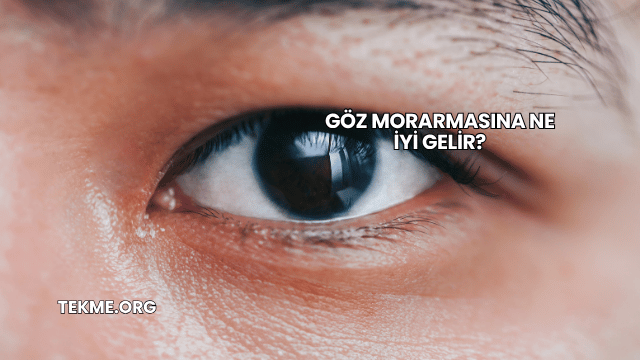 Göz Morarmasına Ne İyi Gelir?