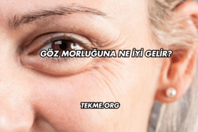 Göz Morluğuna Ne İyi Gelir?