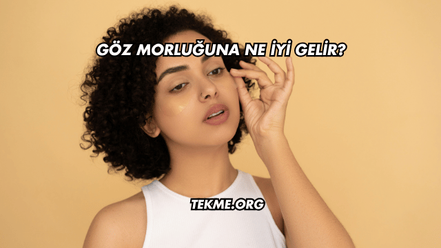 Göz Morluğuna Ne İyi Gelir?
