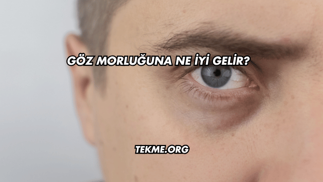 Göz Morluğuna Ne İyi Gelir?