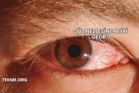Göz Nezlesine Ne İyi Gelir?