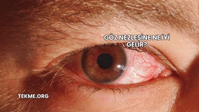 Göz Nezlesine Ne İyi Gelir?