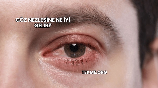 Göz Nezlesine Ne İyi Gelir?