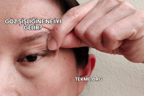 Göz Şişliğine Ne İyi Gelir?