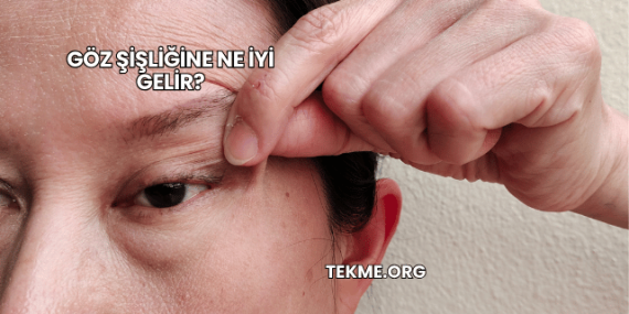 Göz Şişliğine Ne İyi Gelir?