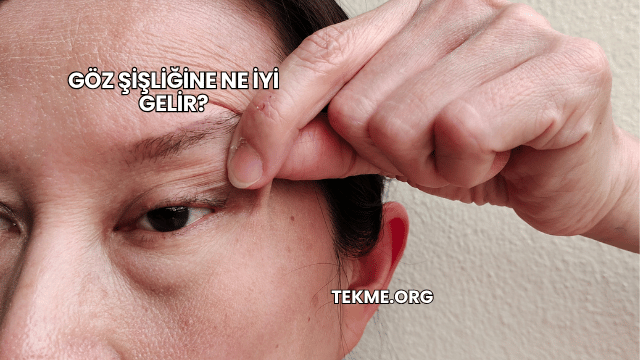 Göz Şişliğine Ne İyi Gelir?