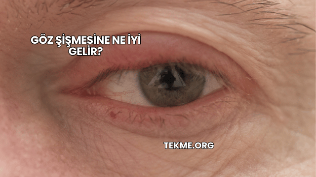 Göz Şişmesine Ne İyi Gelir?