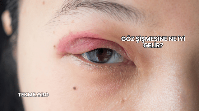 Göz Şişmesine Ne İyi Gelir?