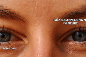 Göz Sulanmasına Ne İyi Gelir?